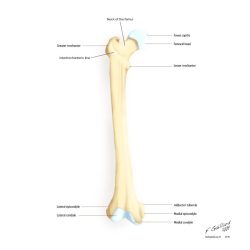 Fracture femoral chiron classification dislocations dislocation