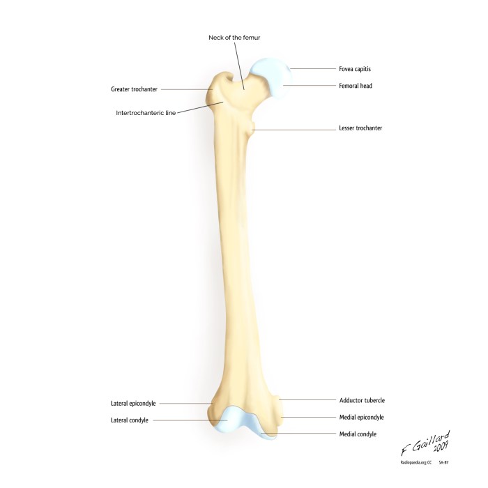 Fracture femoral chiron classification dislocations dislocation